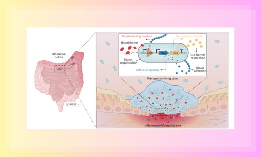 医学部黄鹏教授团队在Nature Biotechnology发表智能活胶水自主感知与精准治疗炎症性肠病研究成果